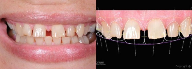 smile gallery