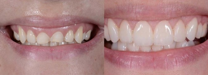 smile gallery