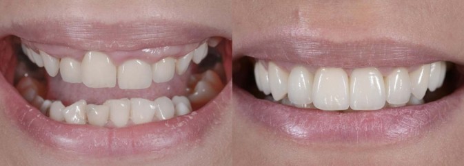 smile gallery