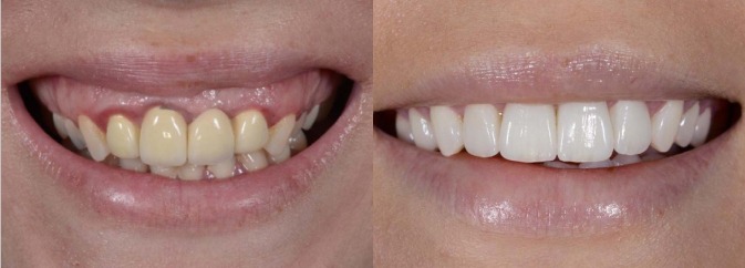 smile gallery