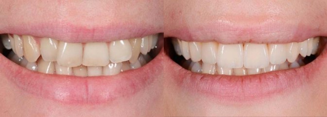 smile gallery