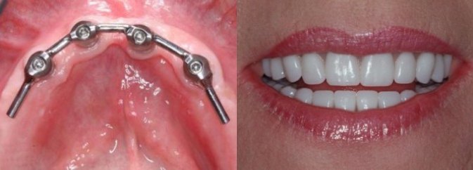 smile gallery